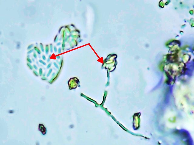 Acremonium phialides and conidial clusters under microscopy at Scaada NZ laboratory