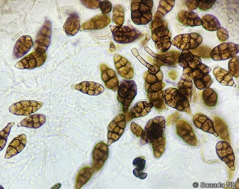 Alternaria (Ulocladium) spores under microscopy at Scaada NZ laboratory