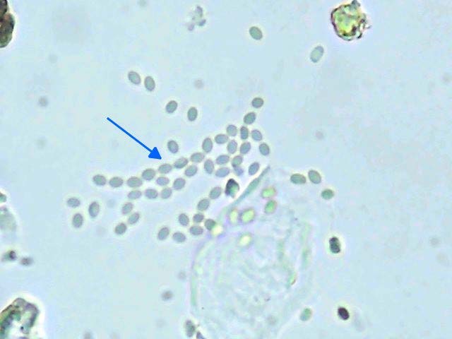 Aspergillus spore cluster identified in a New Zealand indoor air sample at the Scaada NZ laboratory