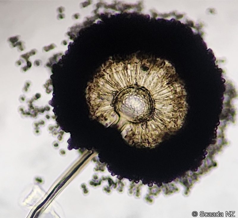 Aspergillus spores under microscopy at Scaada NZ laboratory
