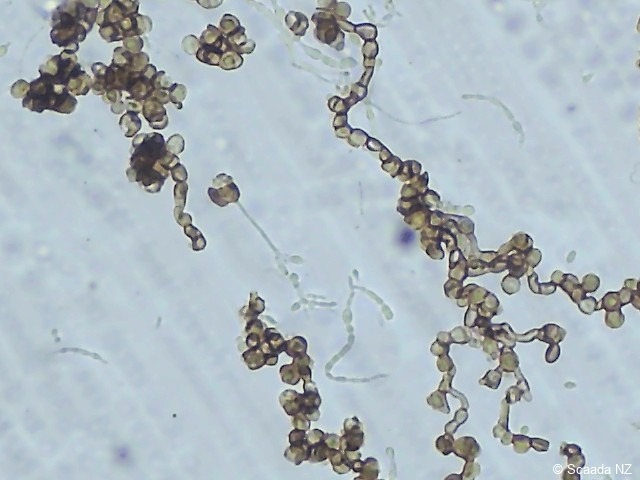 Aureobasidium pullulans under microscope — Scaada NZ laboratory