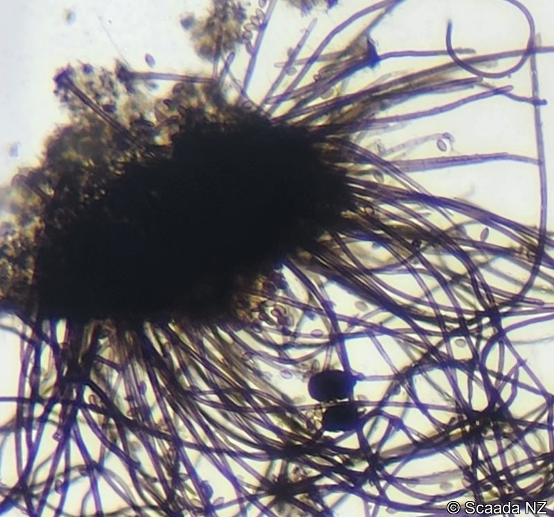 Chaetomium perithecia under microscopy at Scaada NZ laboratory