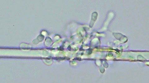 Chrysosporium conidia on a fibre substrate under microscopy at Scaada NZ laboratory