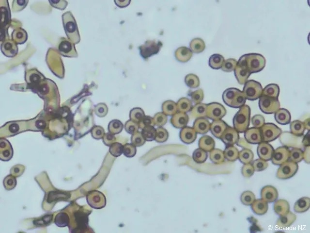 Cladosporium sphaerospermum conidia in chain formation under microscopy at Scaada NZ laboratory