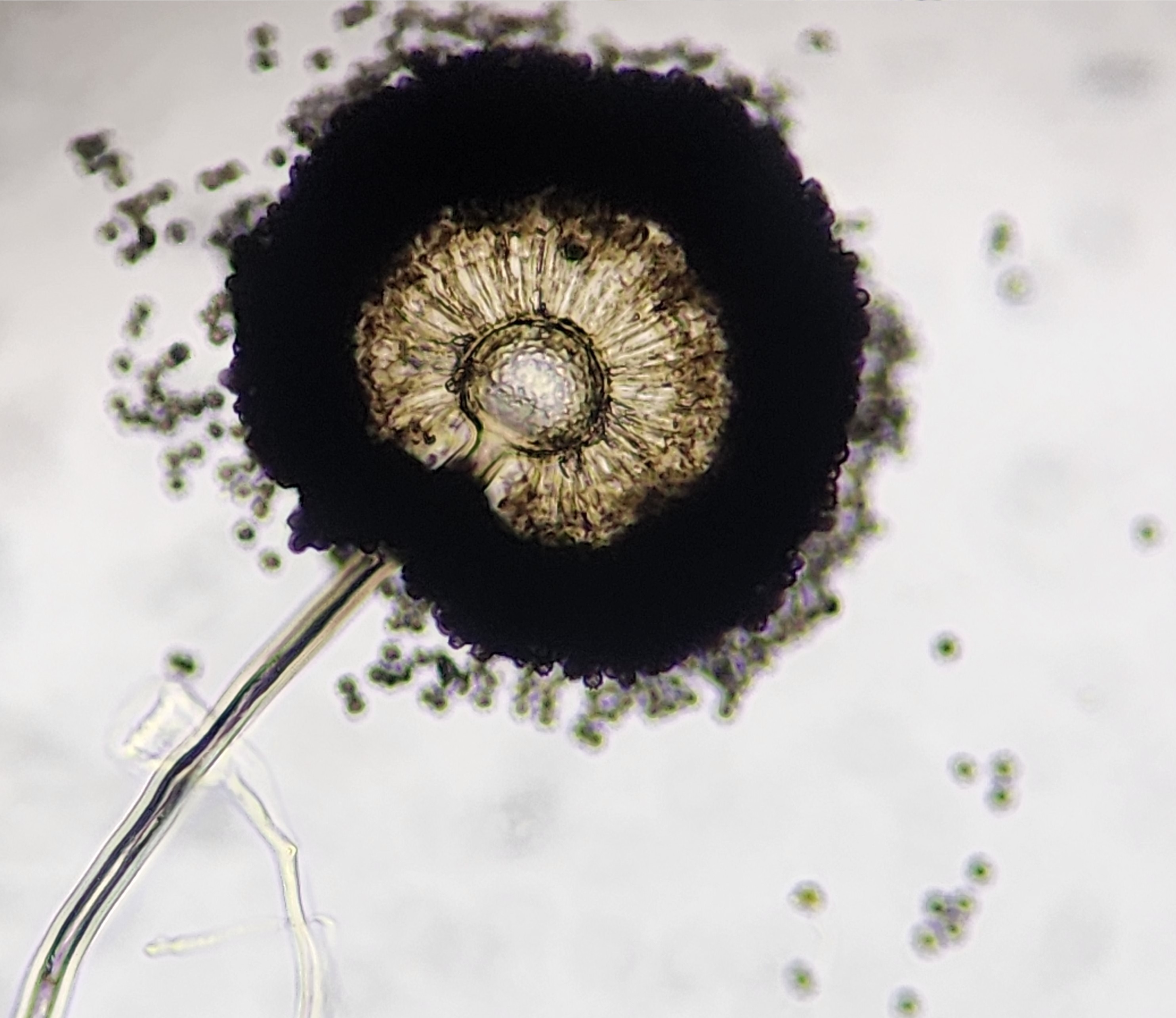 Mould spores under microscope - Scaada NZ Laboratory