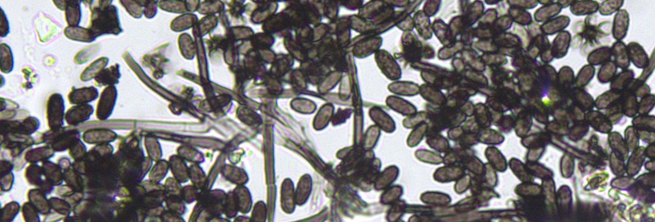 Airborne mould spore analysis