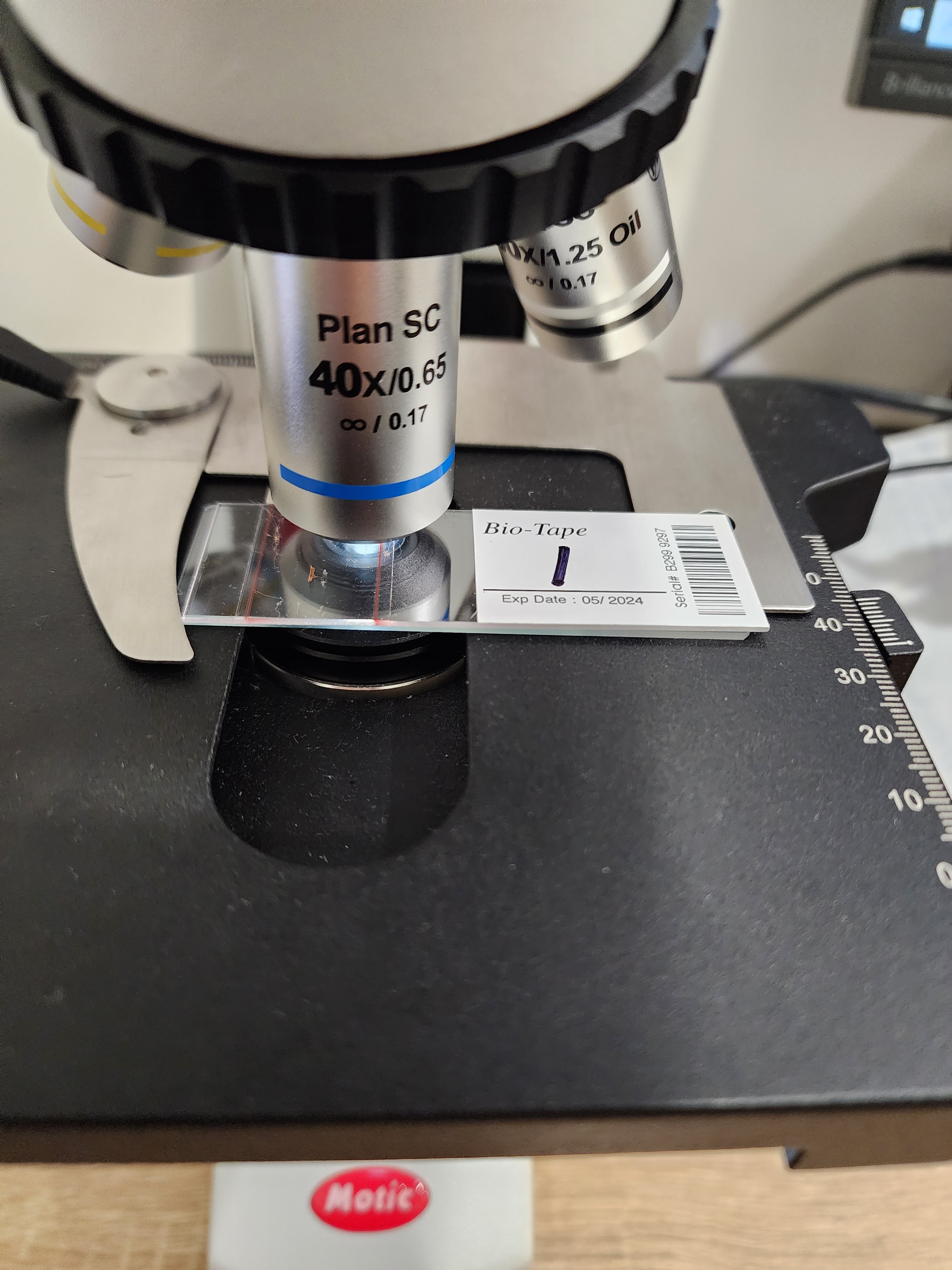 Mould sample under microscope