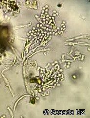 Penicillium conidiophore under phase contrast microscopy at Scaada NZ laboratory