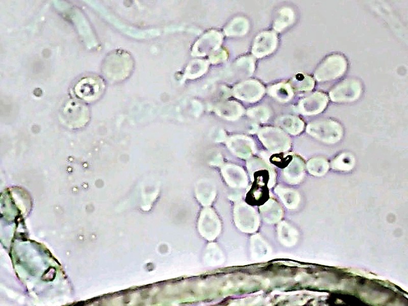 Scopulariopsis conidial chains under microscopy at Scaada NZ laboratory