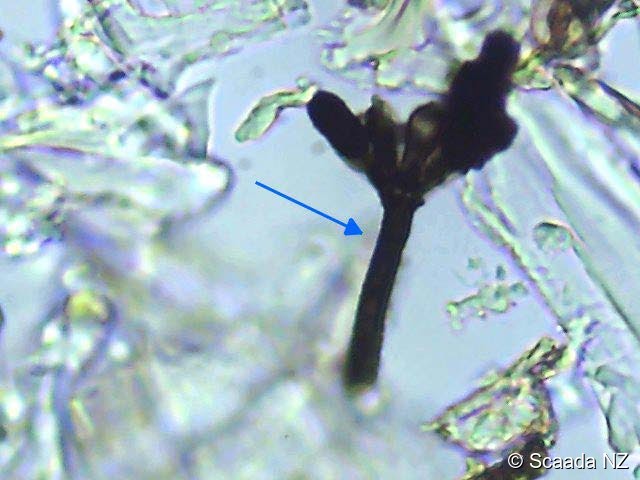 A Stachybotrys conidiophore fragment (arrowed) captured in an indoor air sample under microscopy at the Scaada NZ laboratory