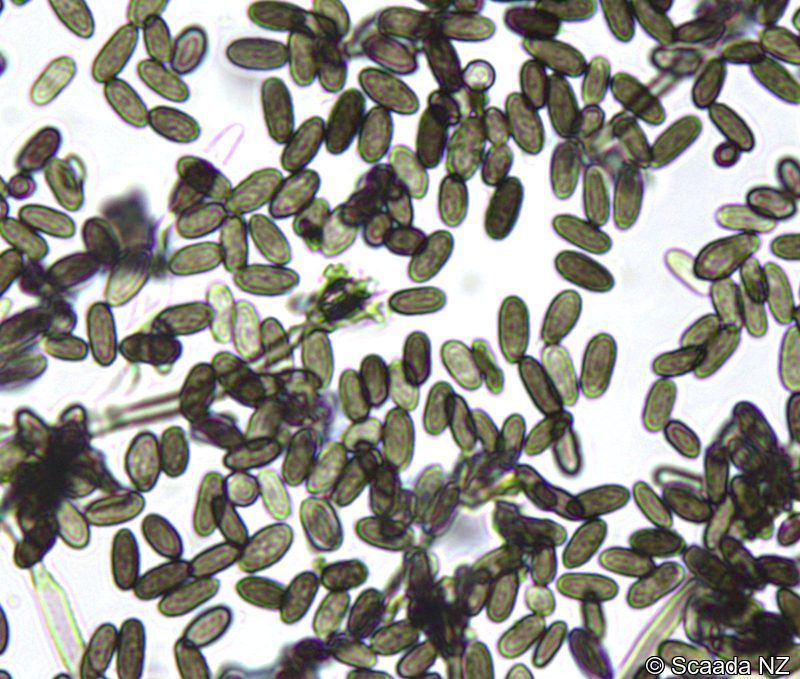 Stachybotrys chartarum (black mould) spores under microscopy at Scaada NZ laboratory