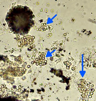 Wallemia mould spores under microscope — Scaada NZ laboratory