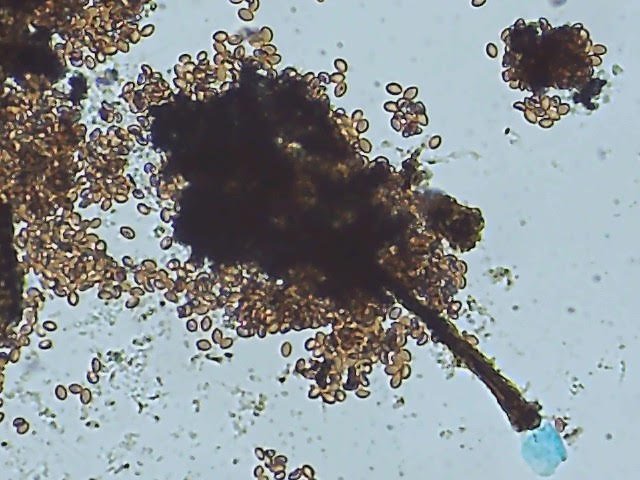 Microscope view of a decayed-timber sample: a dark tangle of fungal threads shedding tough, dark, oval spores from a wood-rot fungus